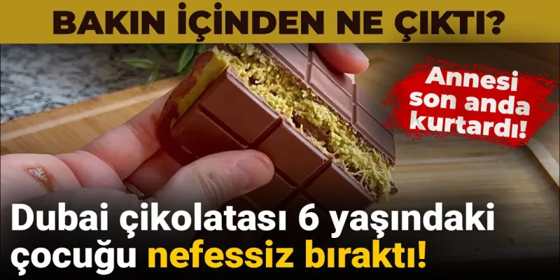 Dubai Çikolatası Faciası! 6 Yaşındaki Çocuk Ölümden Döndü