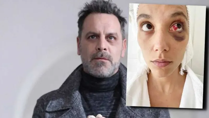 Ozan Güven'e Hapis Şoku! Eski Sevgiliyi Darp Etmenin Bedeli